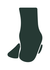 Hypertonus – pronácia (supinácia)